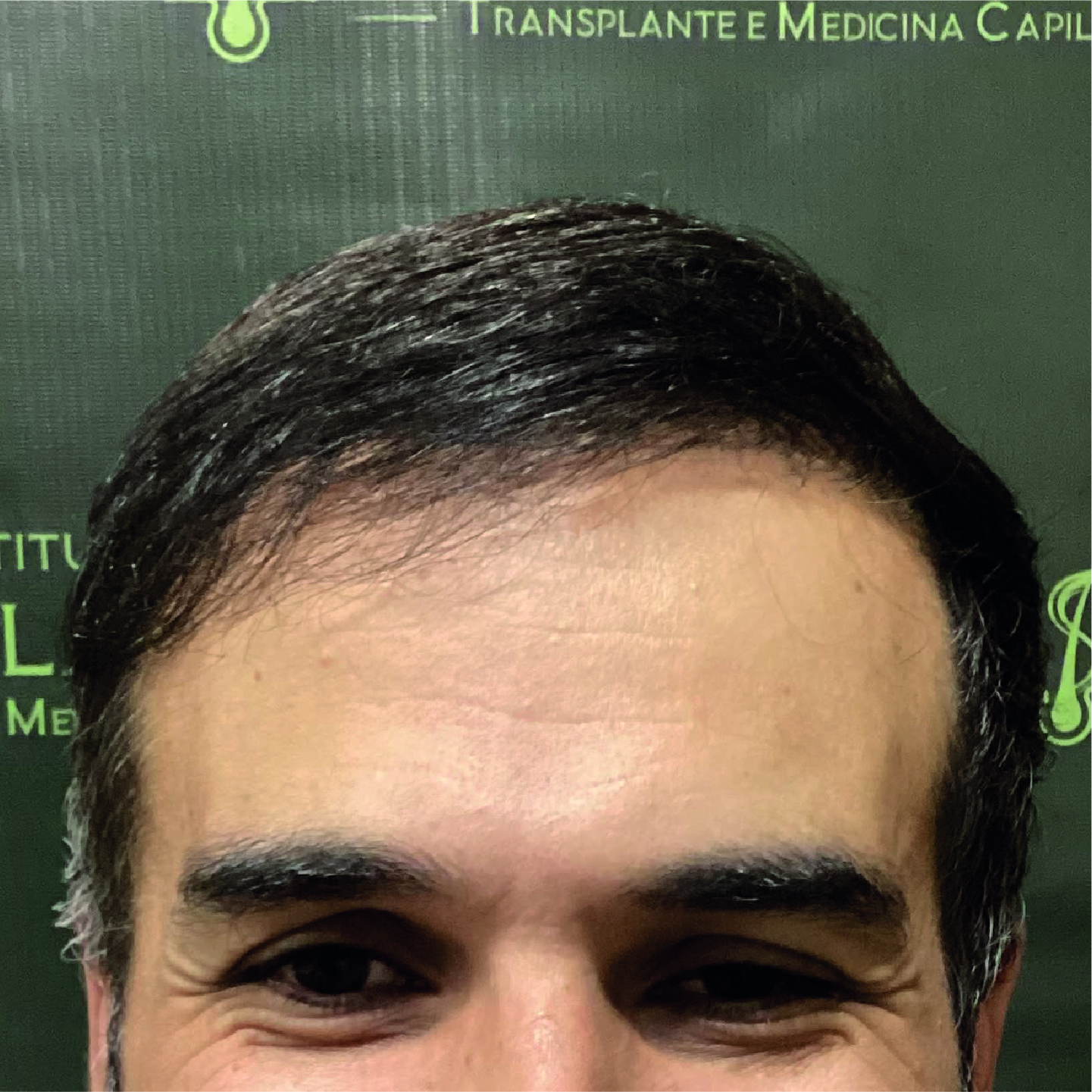 Depois